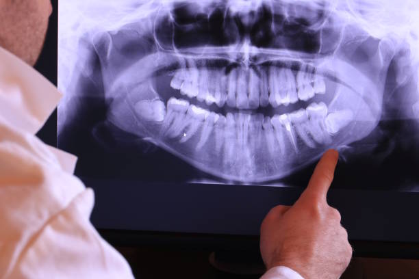 Reliable TX Emergency Dental Service Solutions